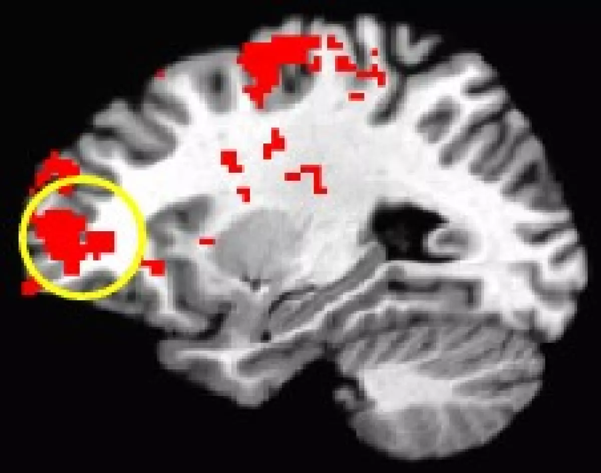 fMRI image of a brain